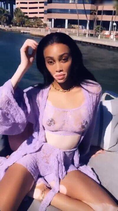 winnieharlow - #18