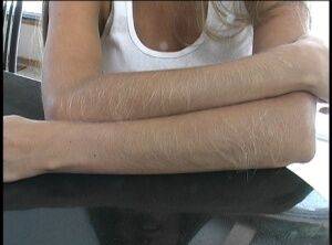 Amateur female Lori Anderson displays her really hairy arms on nudepicso.com